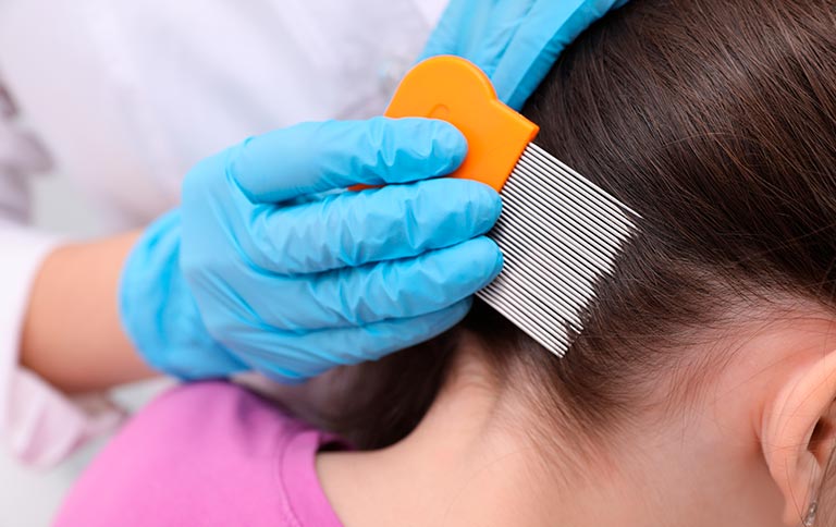 prevenir piojos